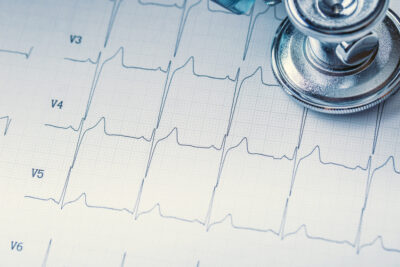 Elektrokardiogramm EKG